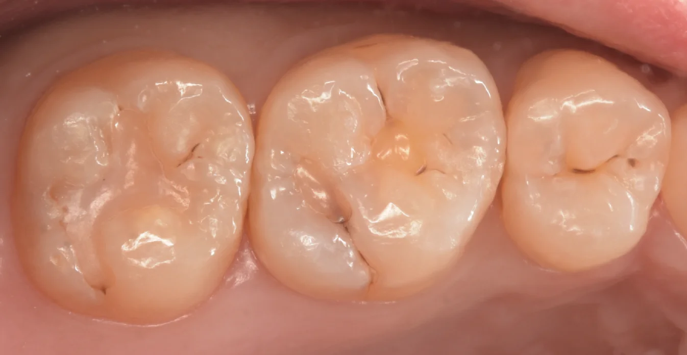 ブログ・お役立ち情報｜坂寄歯科医院（取手市藤代）