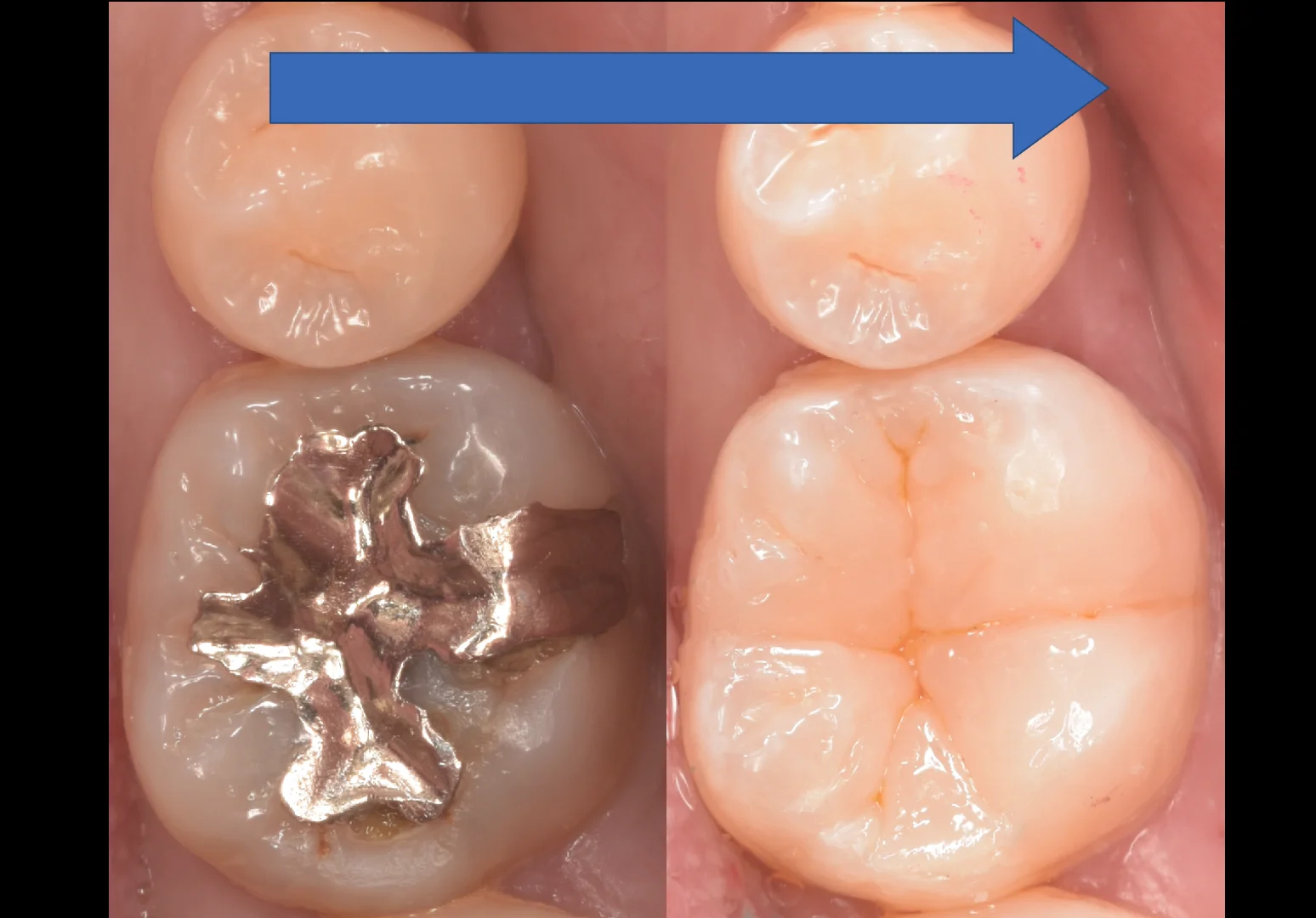 印西からお越しの方｜坂寄歯科医院（取手市藤代） - 画像6