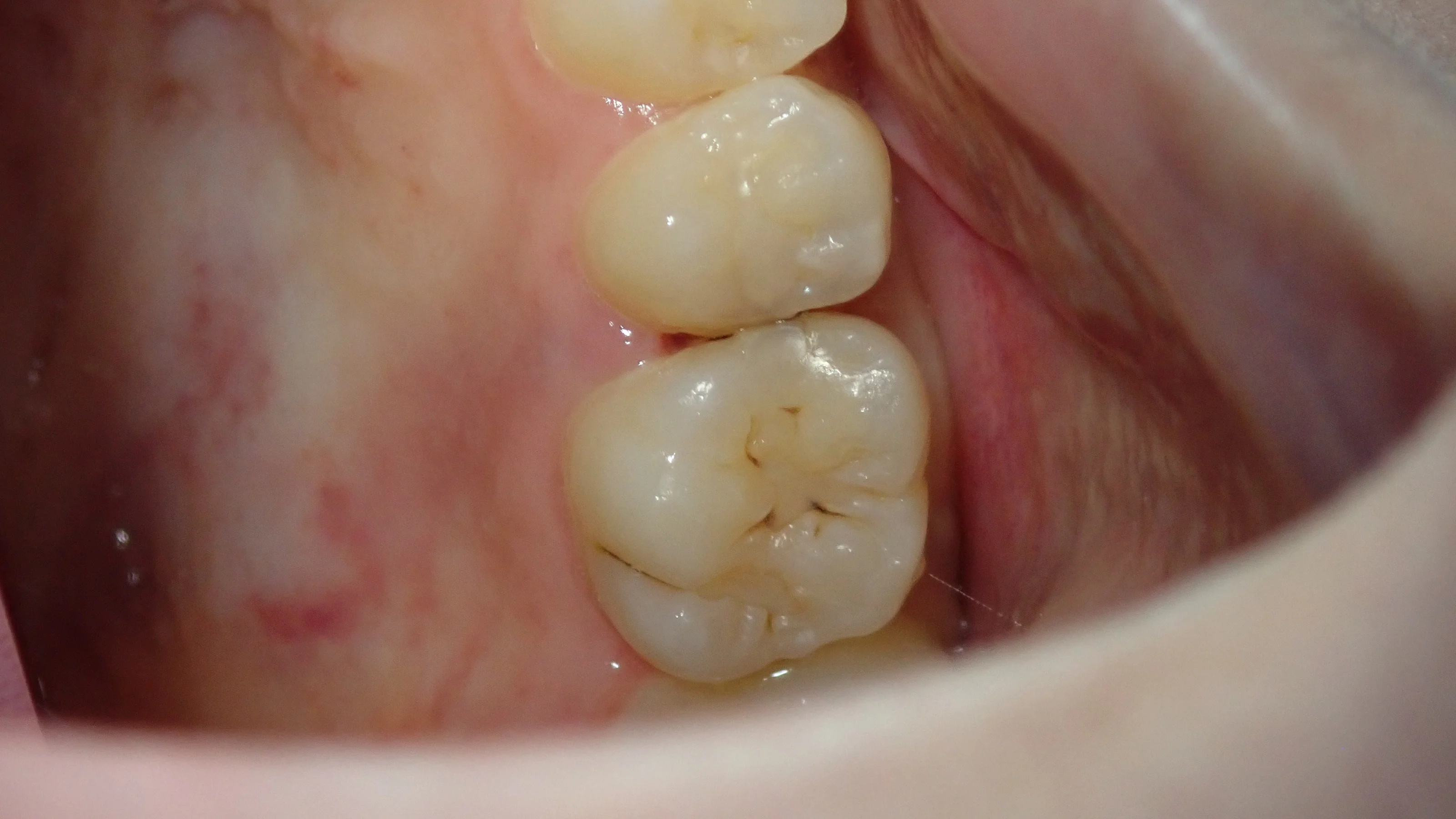 ブログ・お役立ち情報｜坂寄歯科医院（取手市藤代）