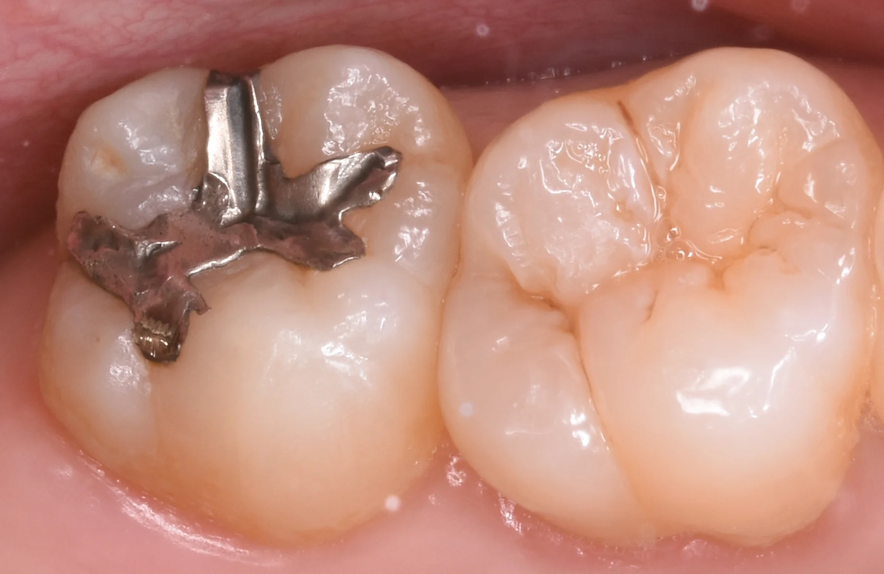 ブログ・お役立ち情報｜坂寄歯科医院（取手市藤代）