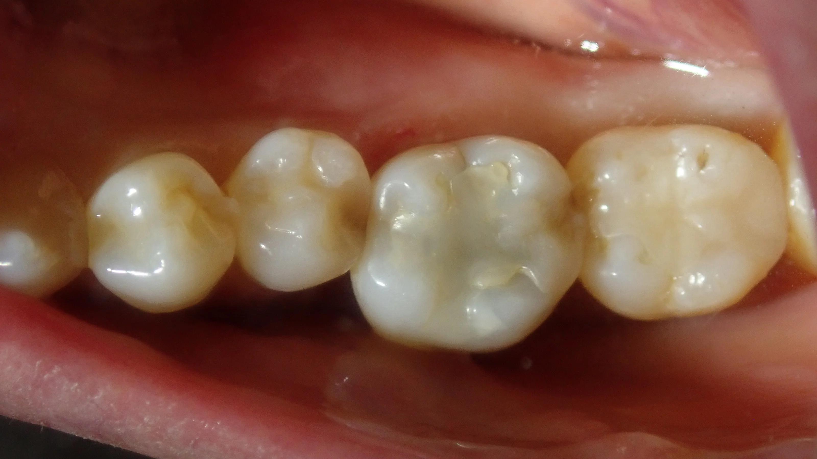 ブログ・お役立ち情報｜坂寄歯科医院（取手市藤代）