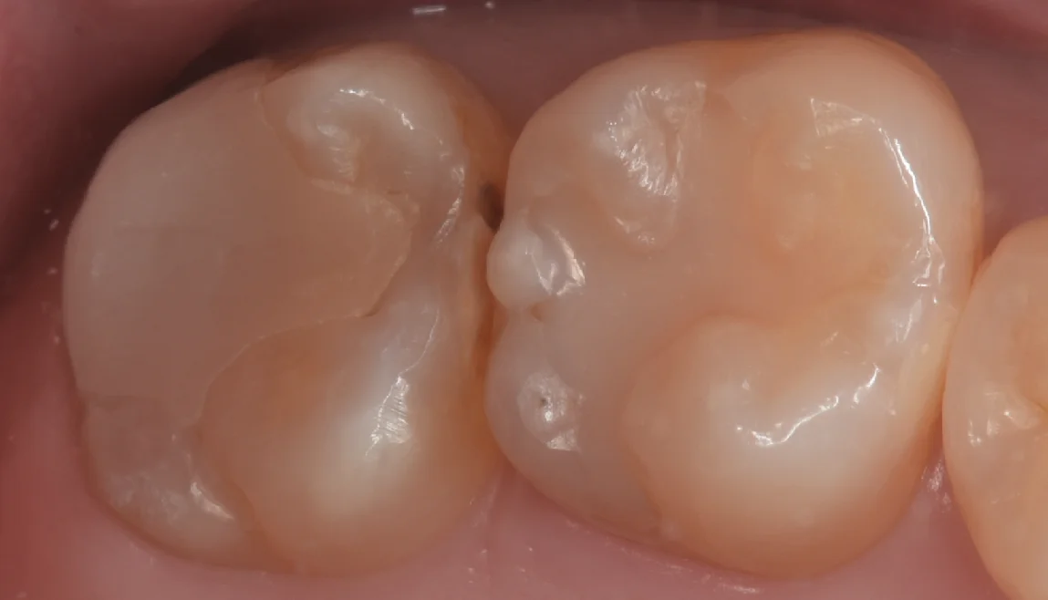 ブログ・お役立ち情報｜坂寄歯科医院（取手市藤代）