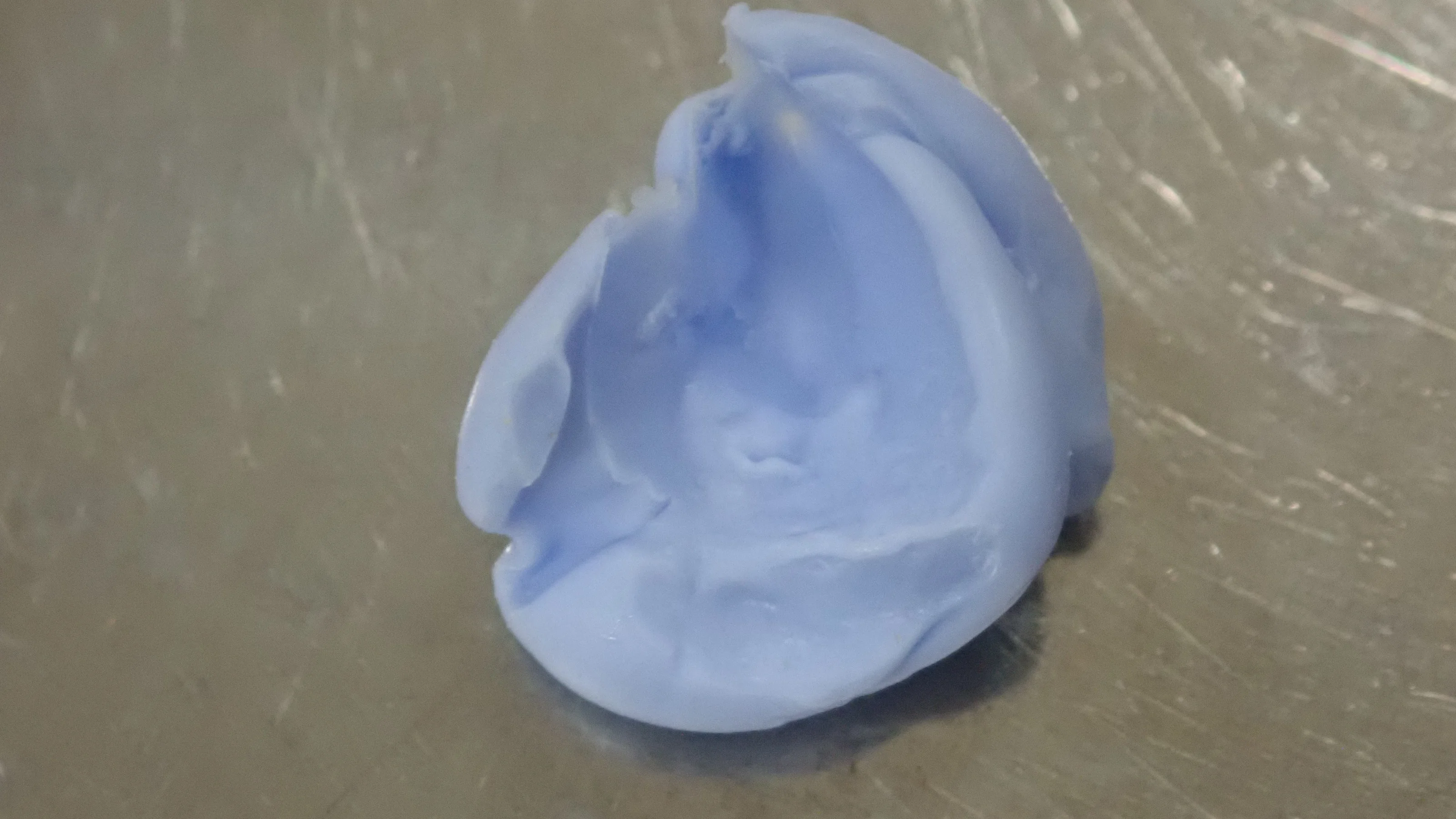 右上犬歯の白い詰め物|坂寄歯科医院(取手市藤代) - 画像4