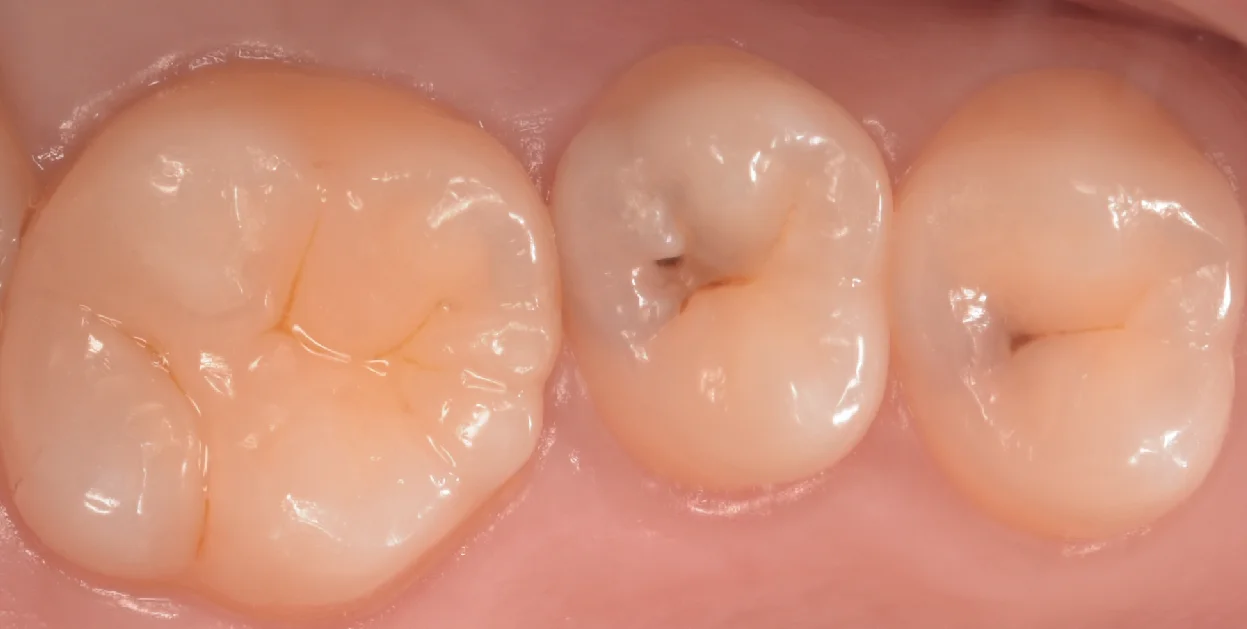 ブログ・お役立ち情報｜坂寄歯科医院（取手市藤代）