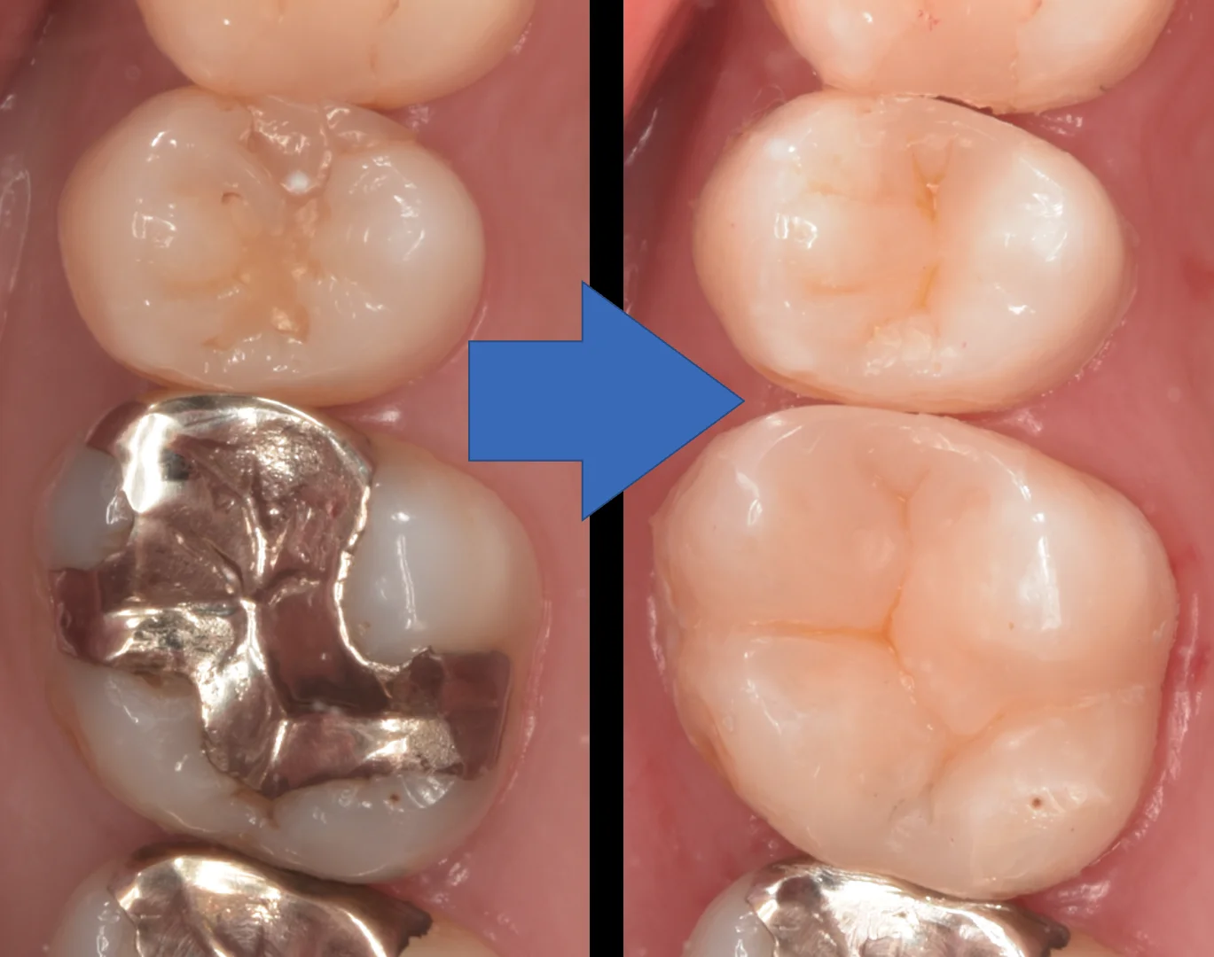 歯科医師の方を治療。|坂寄歯科医院(取手市藤代) - 画像5