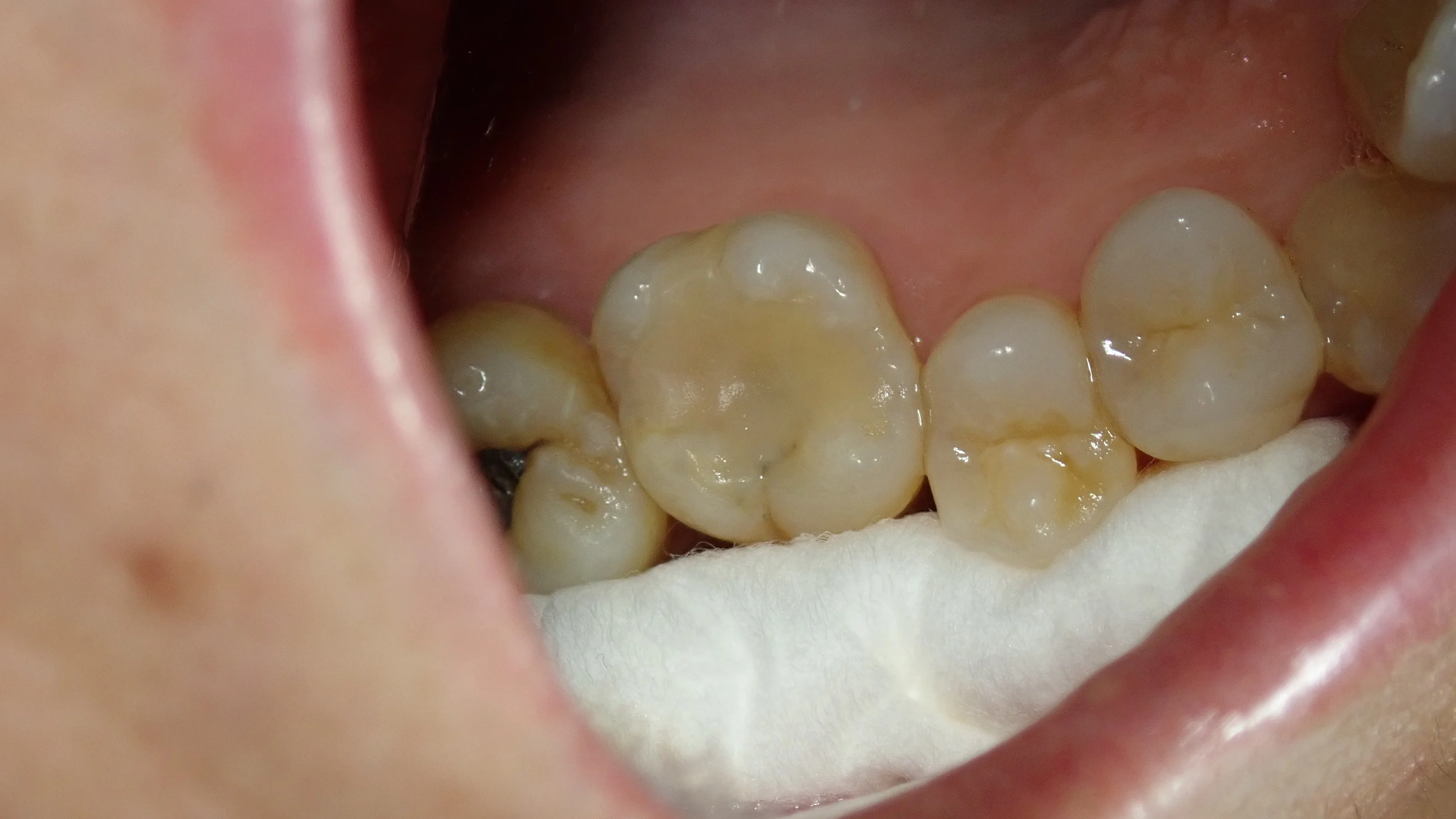 ブログ・お役立ち情報｜坂寄歯科医院（取手市藤代）