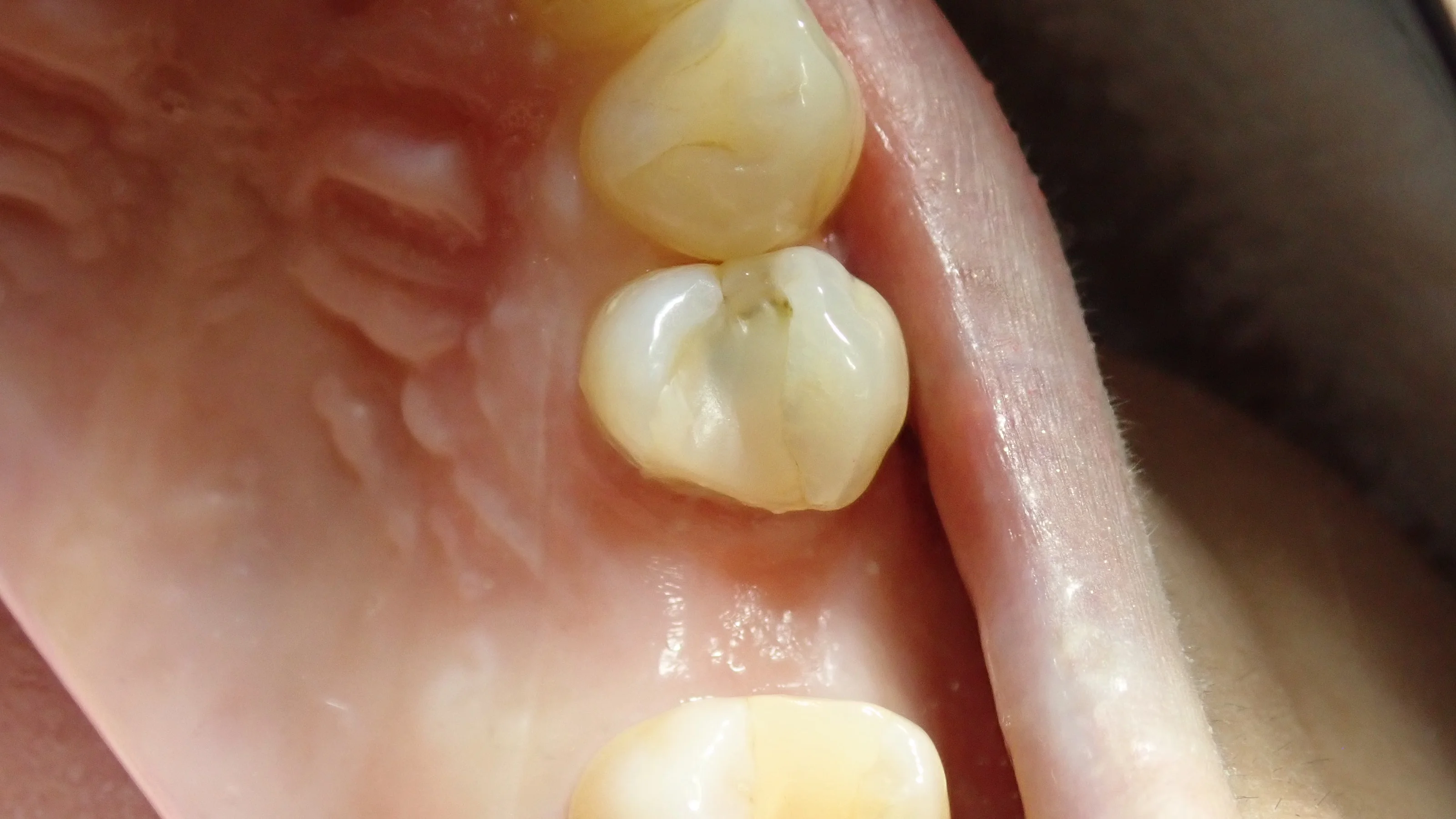 ブログ・お役立ち情報｜坂寄歯科医院（取手市藤代）