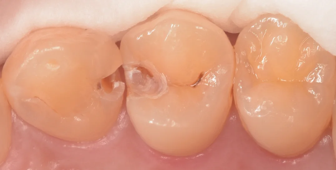 千葉からお越しの歯科衛生士さん。｜坂寄歯科医院（取手市藤代） - 画像2