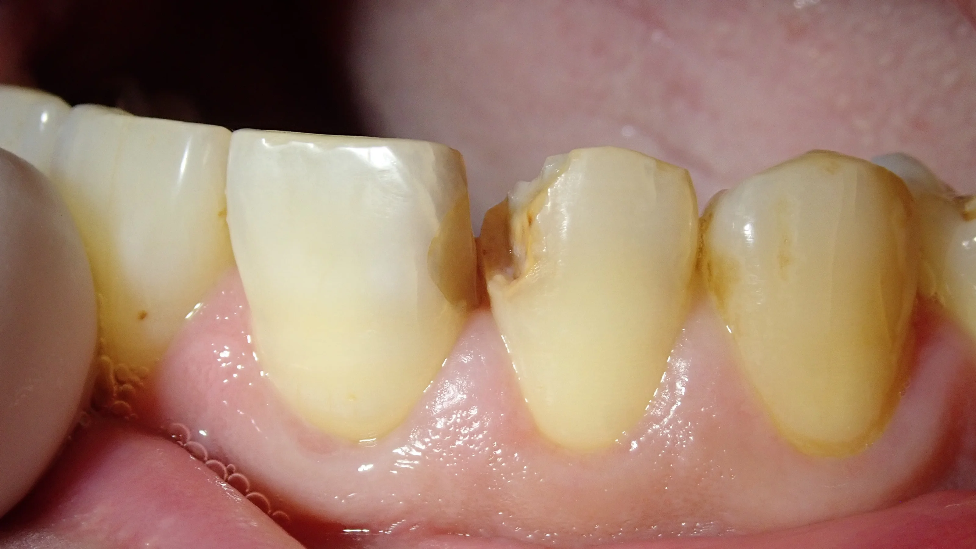 ブログ・お役立ち情報｜坂寄歯科医院（取手市藤代）