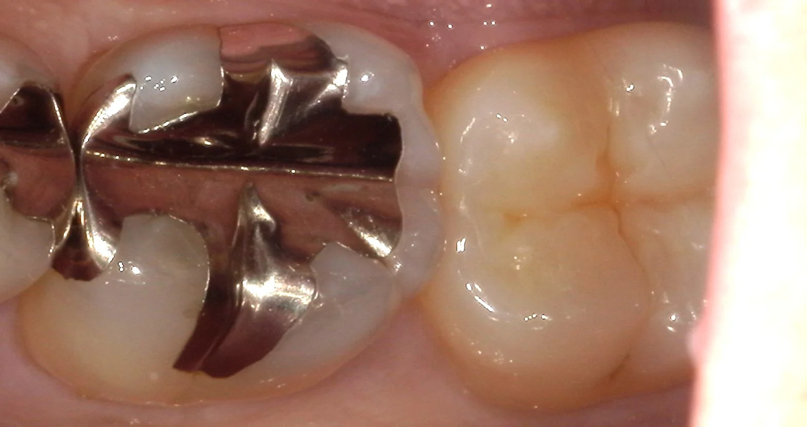 ブログ・お役立ち情報｜坂寄歯科医院（取手市藤代）