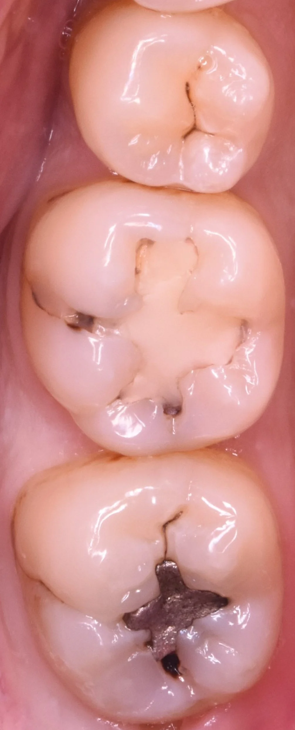 ブログ・お役立ち情報｜坂寄歯科医院（取手市藤代）