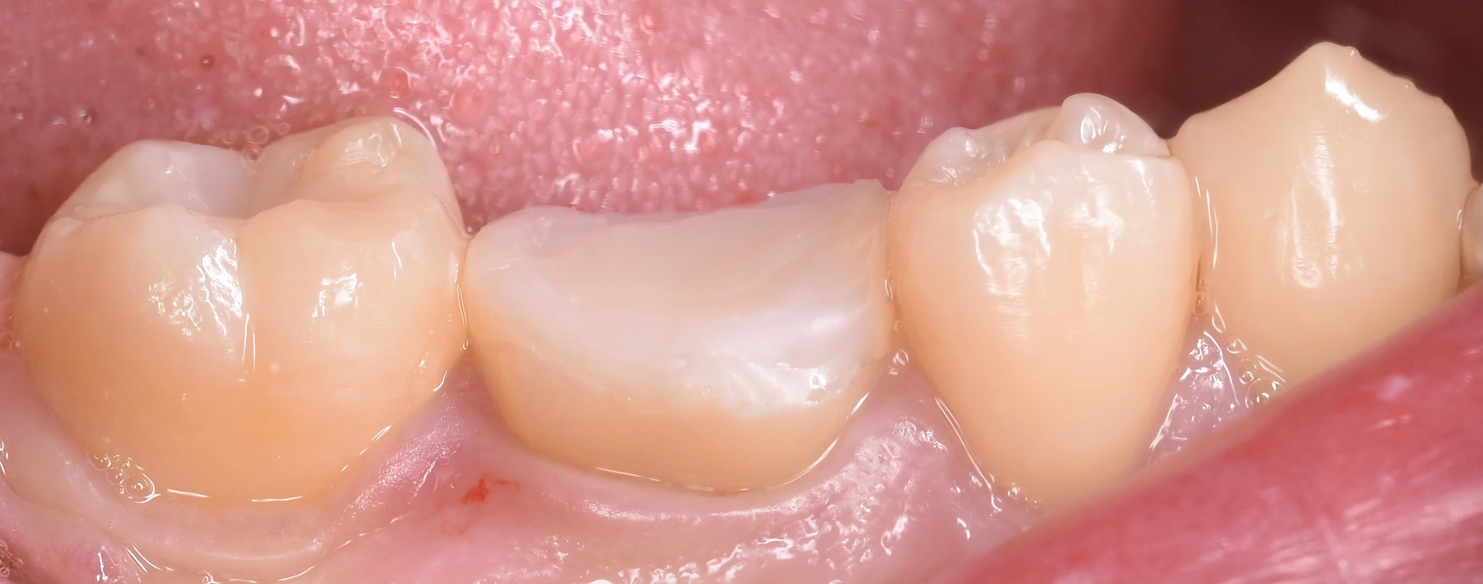 ブログ・お役立ち情報｜坂寄歯科医院（取手市藤代）