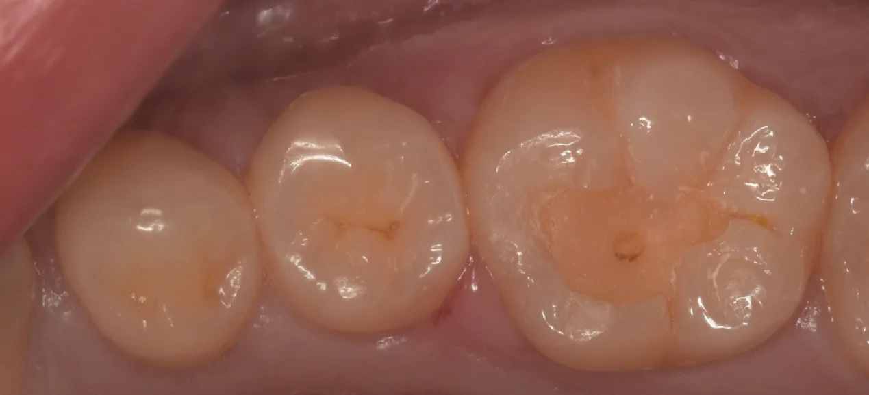 ブログ・お役立ち情報｜坂寄歯科医院（取手市藤代）