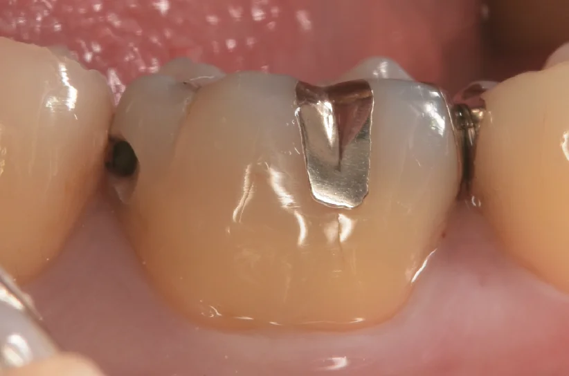 栃木県からお越しの方。｜坂寄歯科医院（取手市藤代） - 画像2