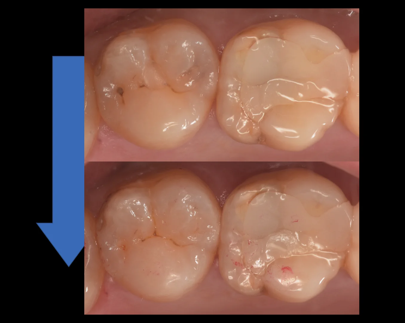 他県より来院された方。|坂寄歯科医院(取手市藤代) - 画像5