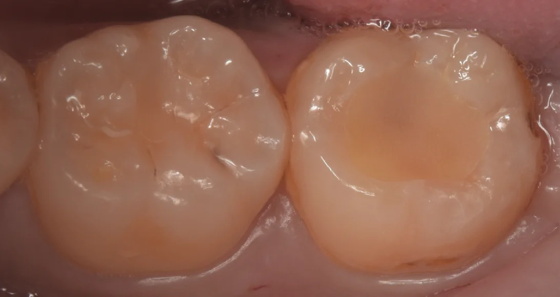 ブログ・お役立ち情報｜坂寄歯科医院（取手市藤代）