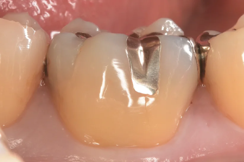 ブログ・お役立ち情報｜坂寄歯科医院（取手市藤代）