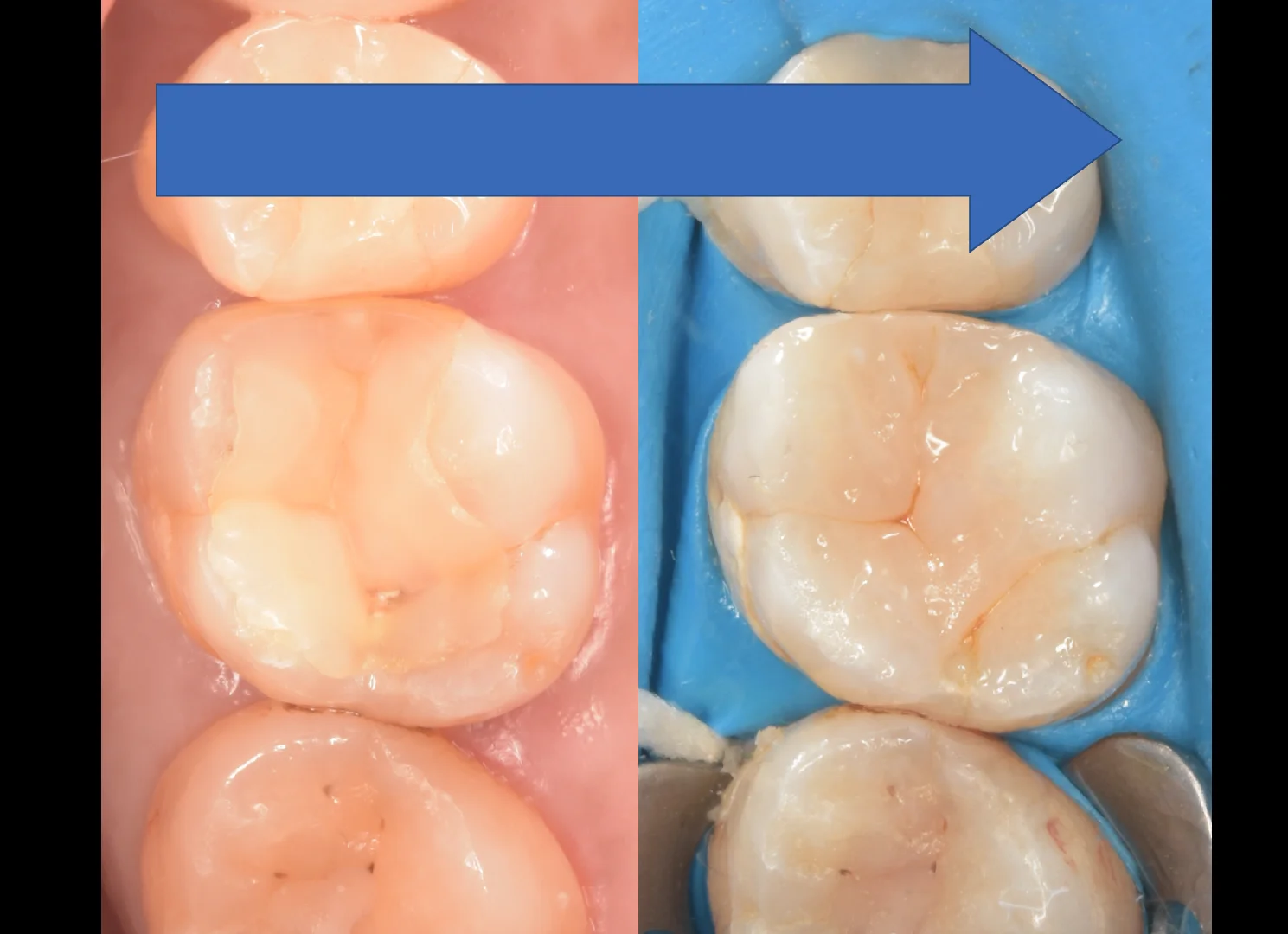 新宿からお越しの方｜坂寄歯科医院（取手市藤代） - 画像5