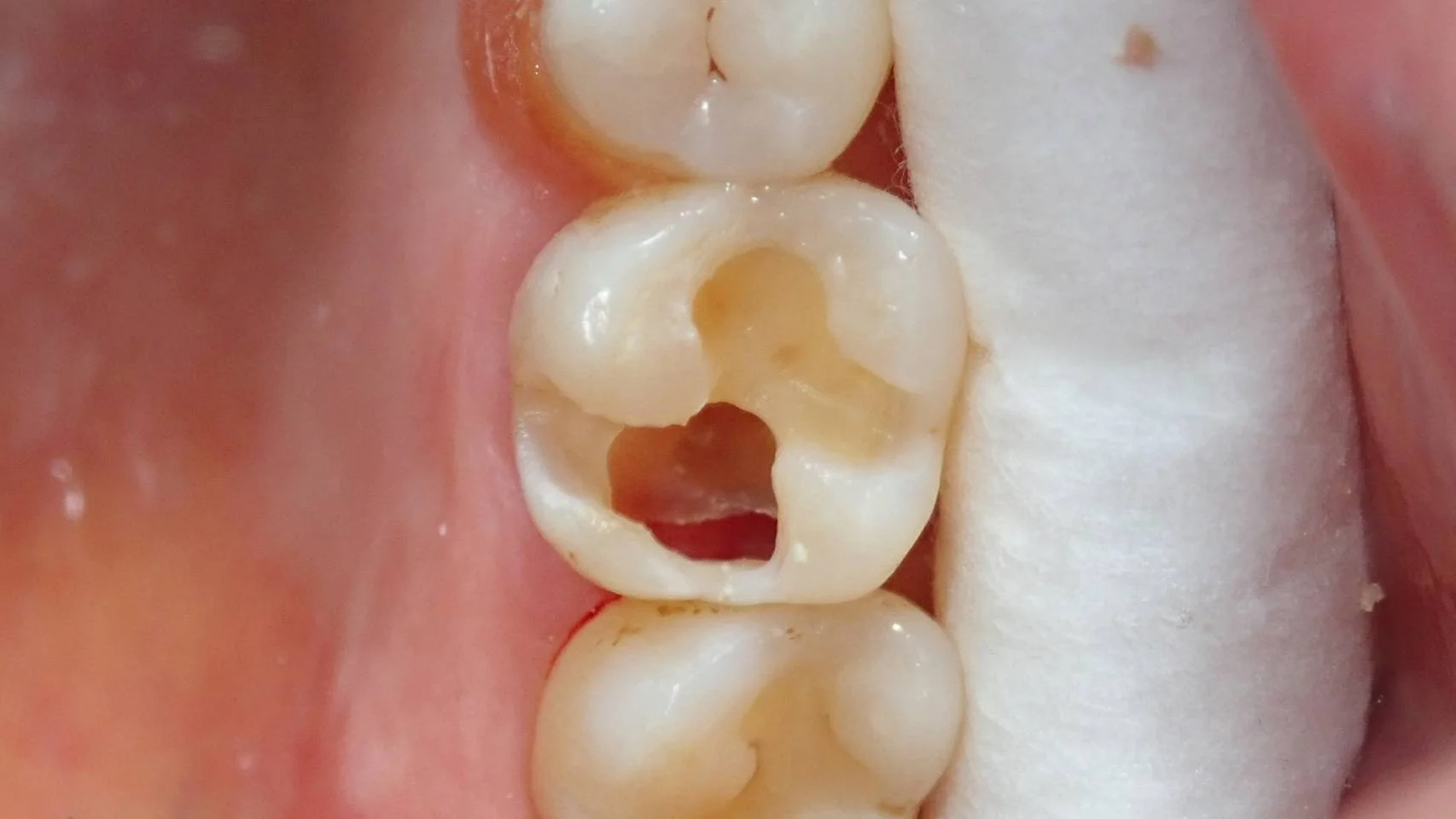 ブログ・お役立ち情報｜坂寄歯科医院（取手市藤代）