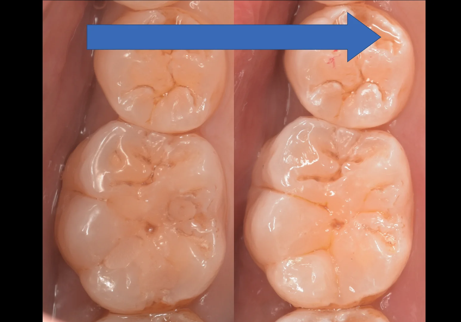 神奈川県からお越しの方|坂寄歯科医院(取手市藤代) - 画像6