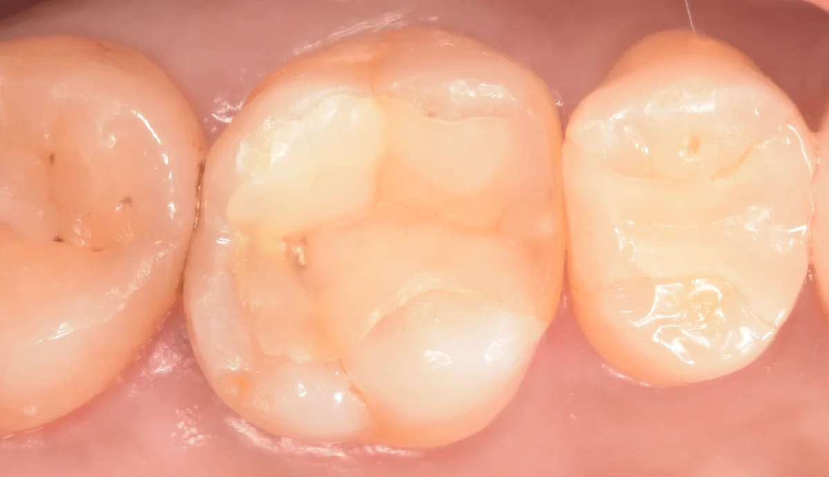 ブログ・お役立ち情報｜坂寄歯科医院（取手市藤代）