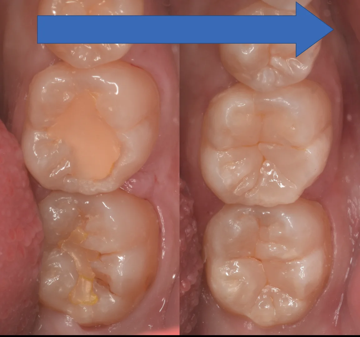 竜ヶ崎市からお越しの方。|坂寄歯科医院(取手市藤代) - 画像5