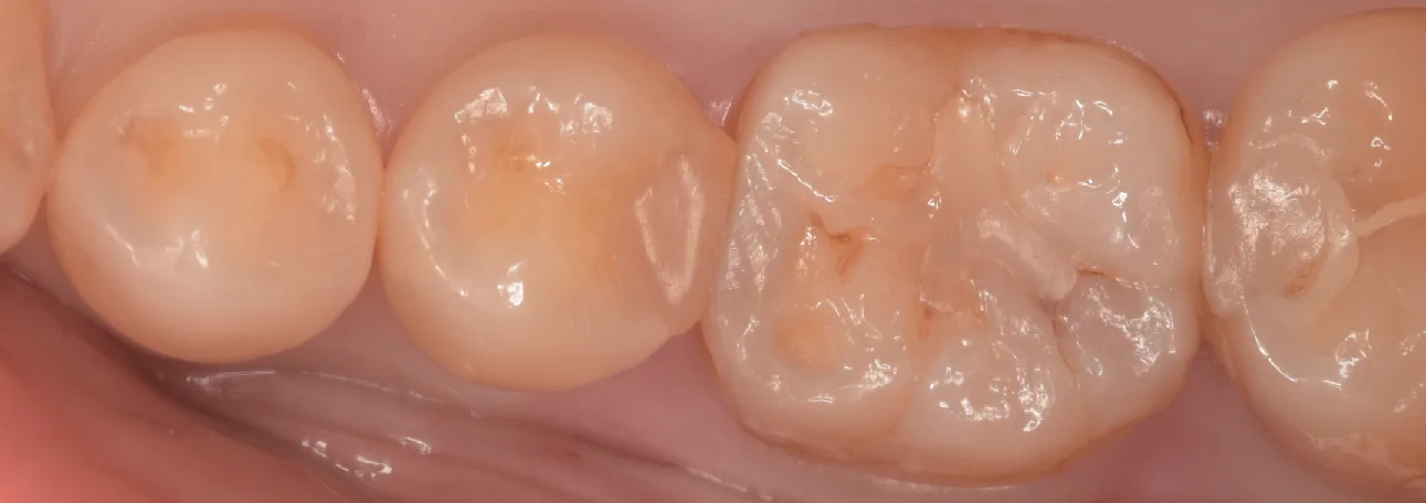 ブログ・お役立ち情報｜坂寄歯科医院（取手市藤代）