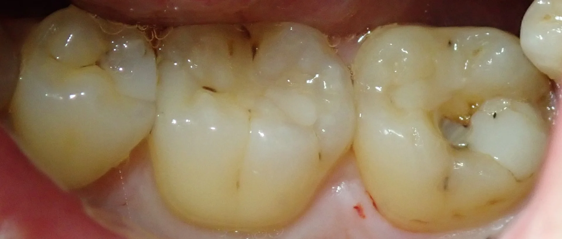 ブログ・お役立ち情報｜坂寄歯科医院（取手市藤代）