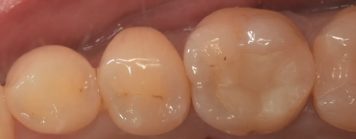 ブログ・お役立ち情報｜坂寄歯科医院（取手市藤代）