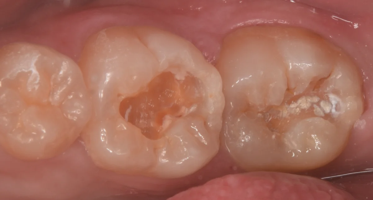 竜ヶ崎市からお越しの方。|坂寄歯科医院(取手市藤代) - 画像2