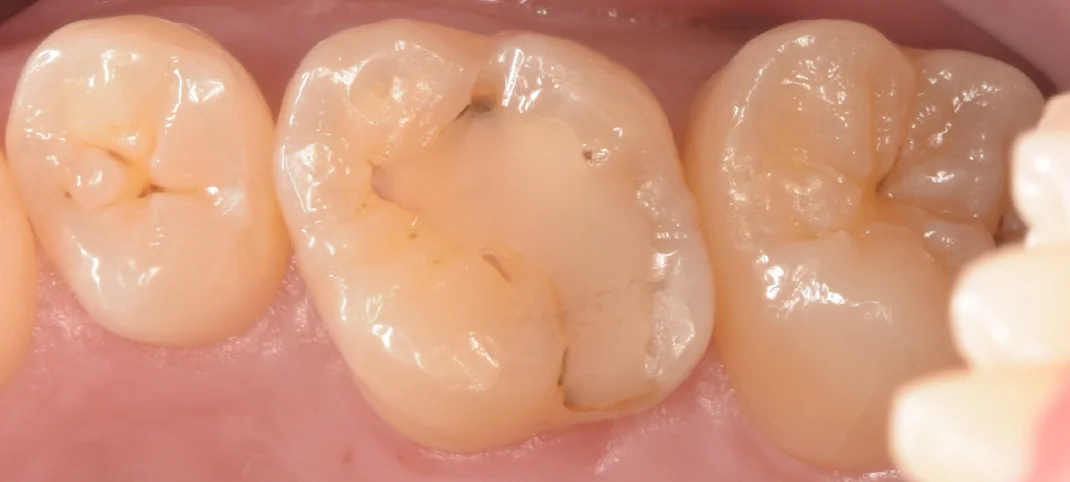 ブログ・お役立ち情報｜坂寄歯科医院（取手市藤代）