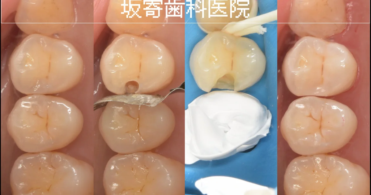 ブログ・お役立ち情報｜坂寄歯科医院（取手市藤代）