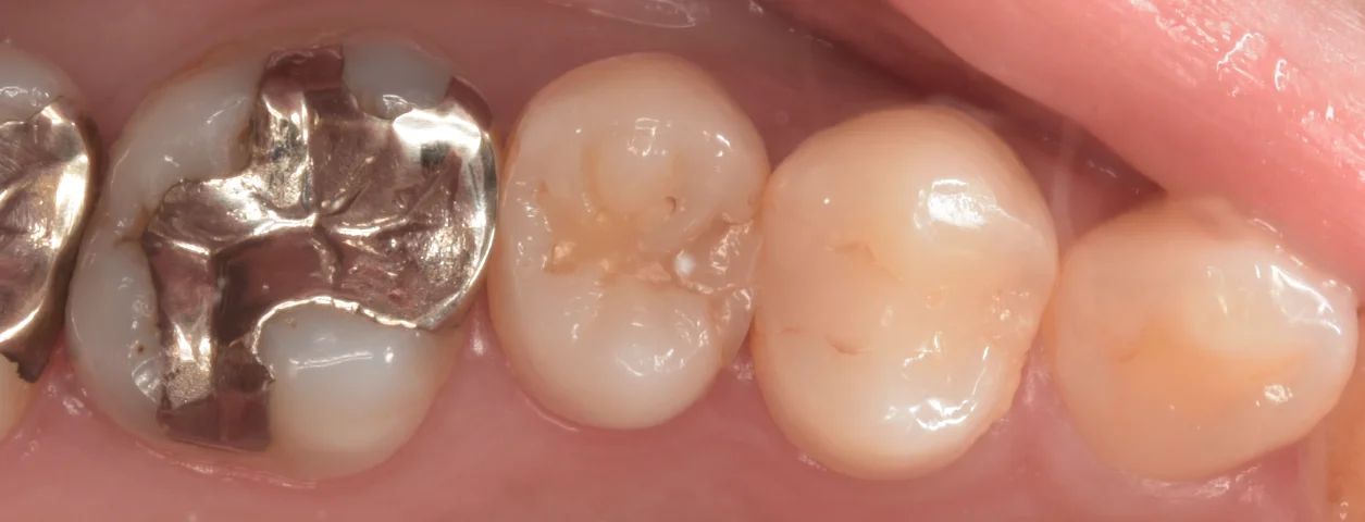 ブログ・お役立ち情報｜坂寄歯科医院（取手市藤代）