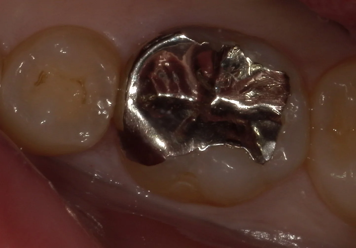 ブログ・お役立ち情報｜坂寄歯科医院（取手市藤代）