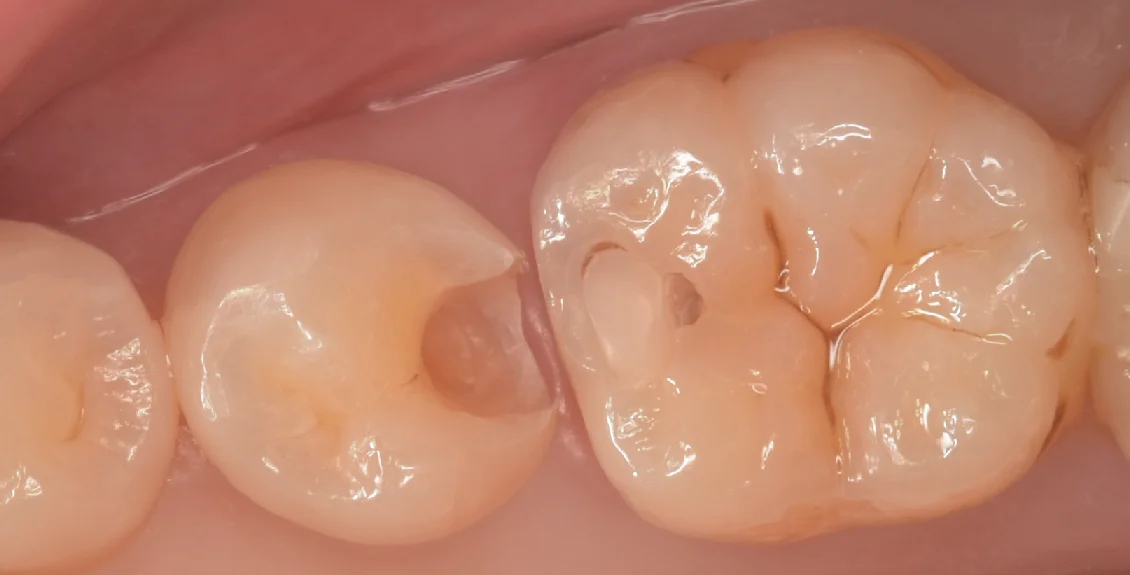 東京都内よりお越しの方をダイレクトで。｜坂寄歯科医院（取手市藤代） - 画像3