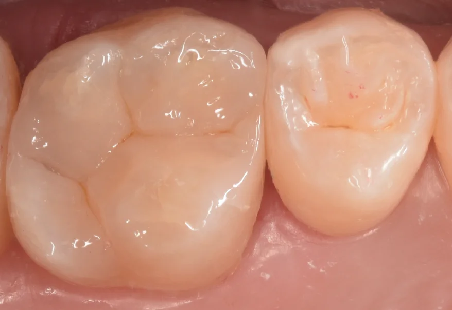 千葉県からお越しの方｜坂寄歯科医院（取手市藤代） - 画像4