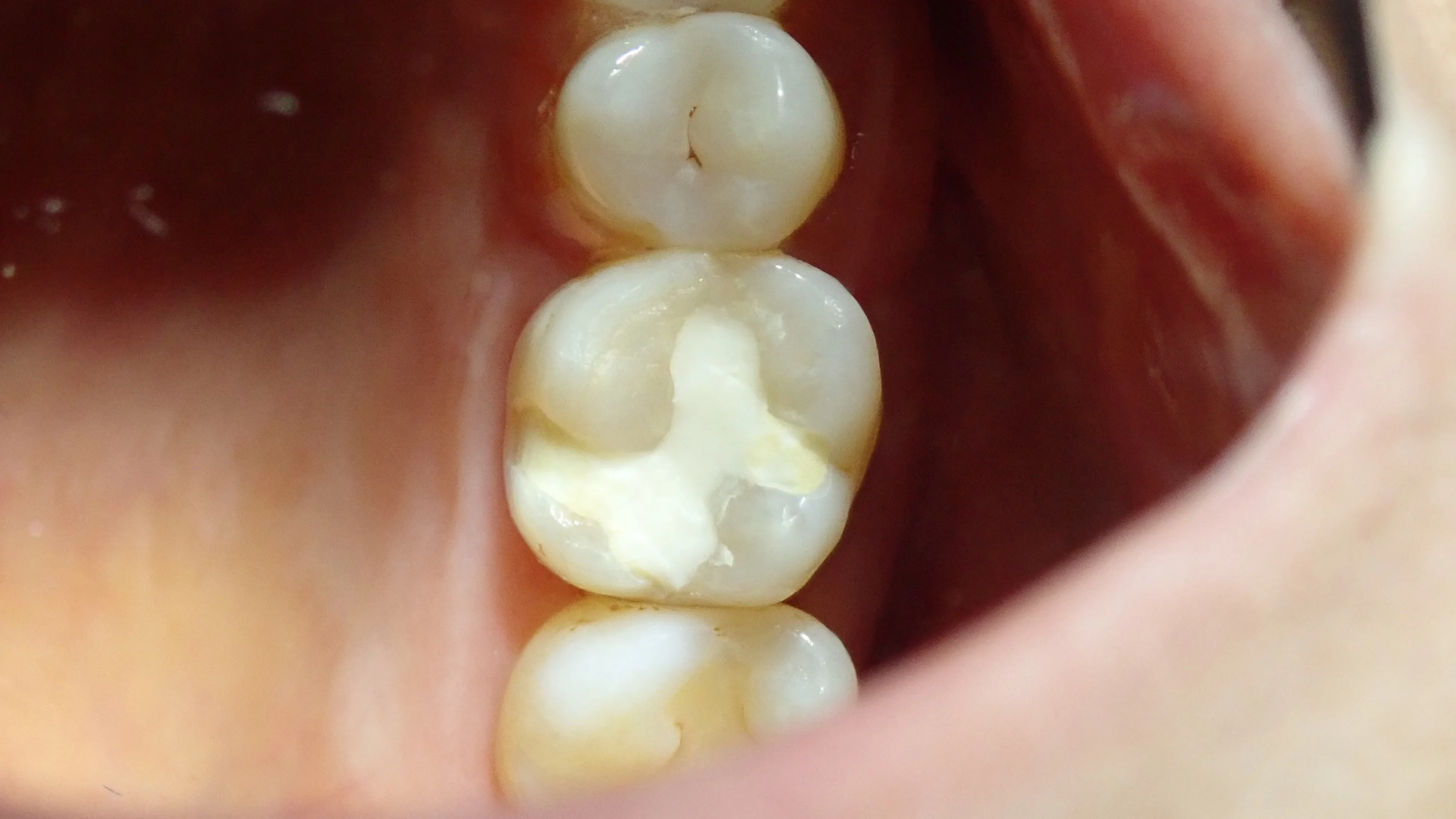 ブログ・お役立ち情報｜坂寄歯科医院（取手市藤代）