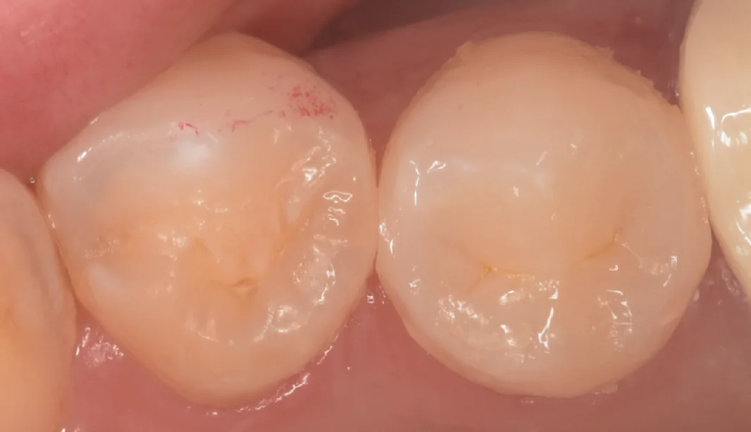 東京都からお越しの方｜坂寄歯科医院（取手市藤代） - 画像3