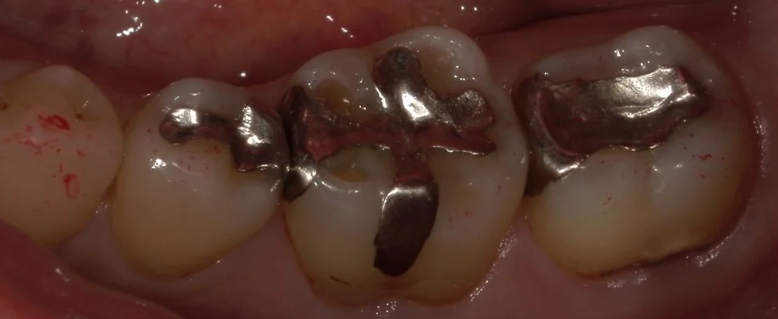 ブログ・お役立ち情報｜坂寄歯科医院（取手市藤代）