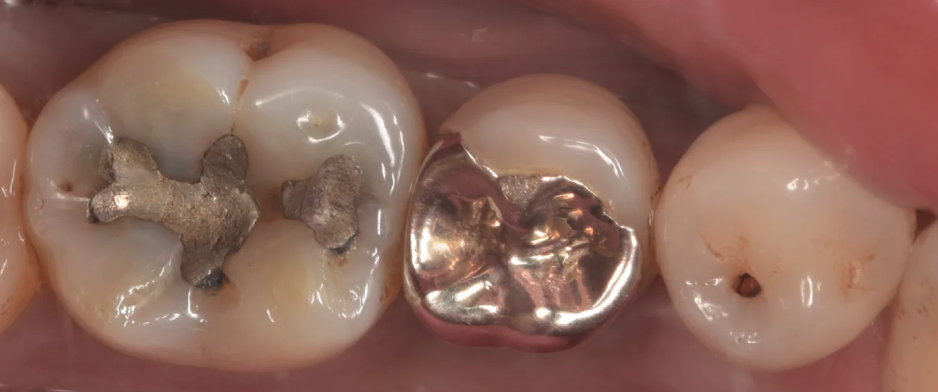 ブログ・お役立ち情報｜坂寄歯科医院（取手市藤代）