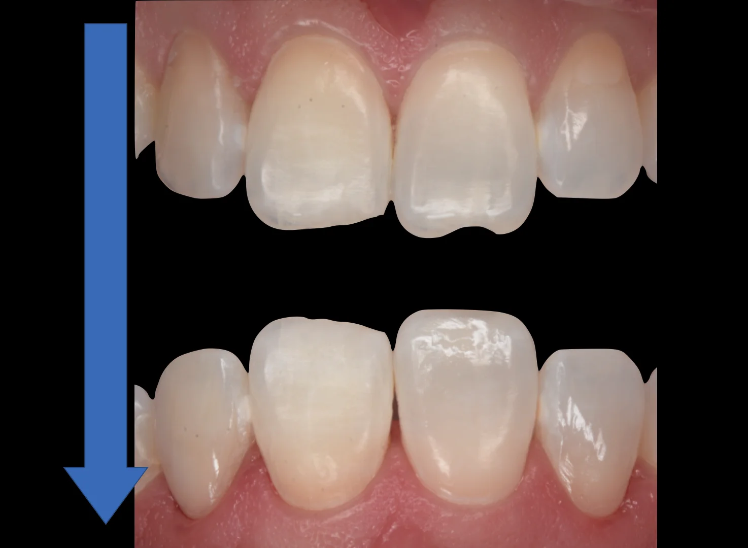 目黒からお越しの方｜坂寄歯科医院（取手市藤代） - 画像5