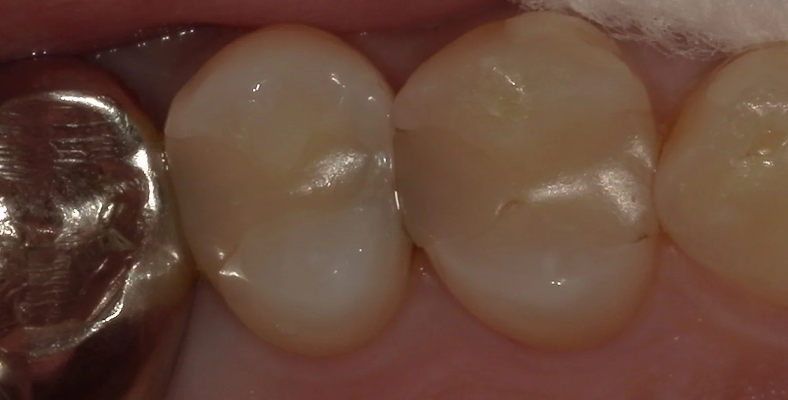 ブログ・お役立ち情報｜坂寄歯科医院（取手市藤代）