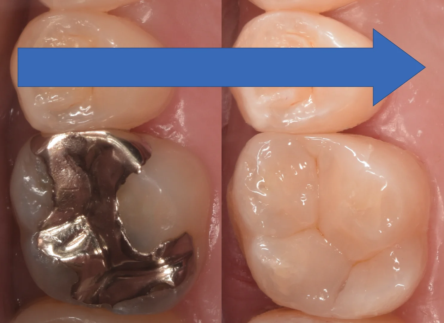 千葉県からお越しの方｜坂寄歯科医院（取手市藤代） - 画像5