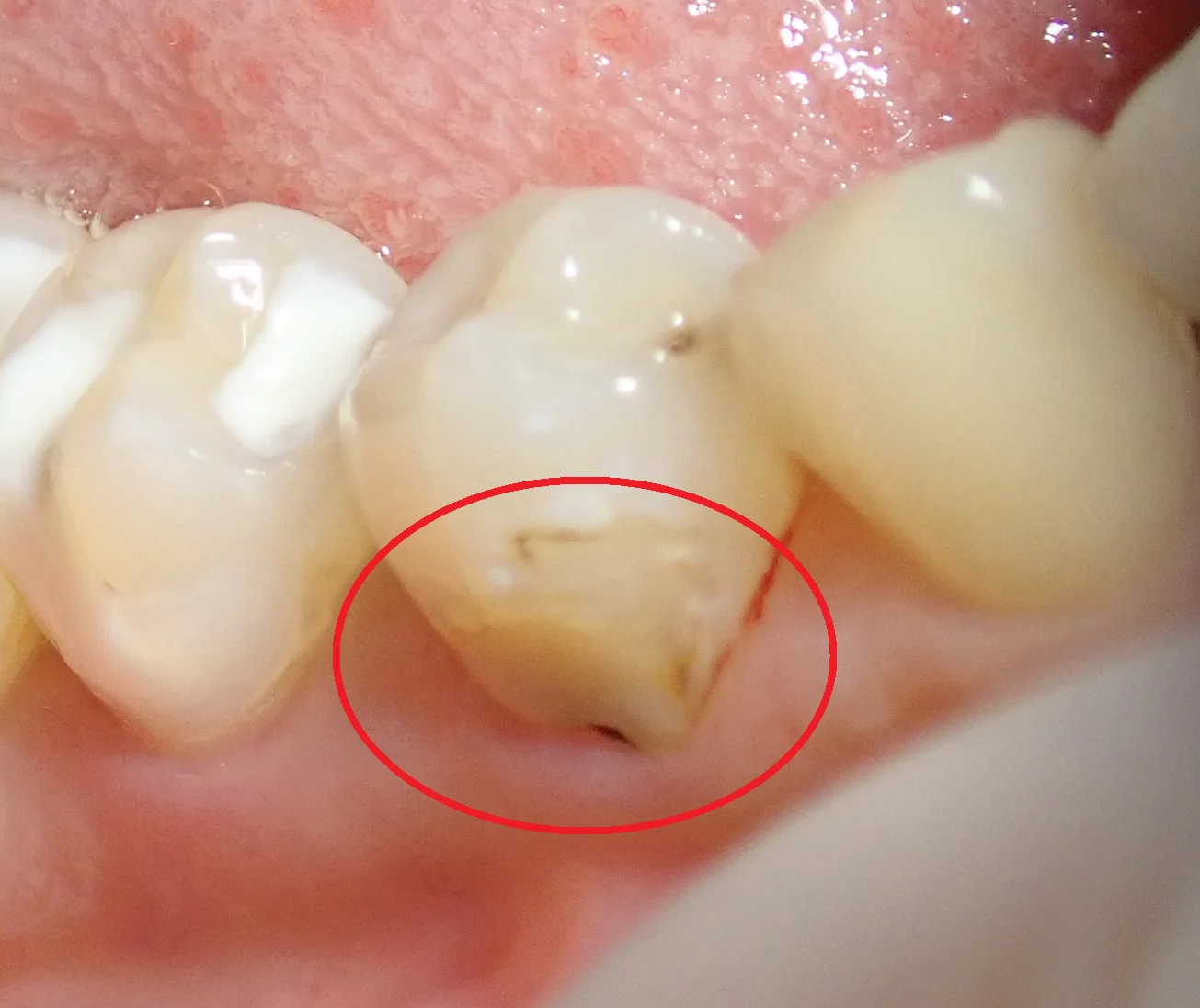 ブログ・お役立ち情報｜坂寄歯科医院（取手市藤代）