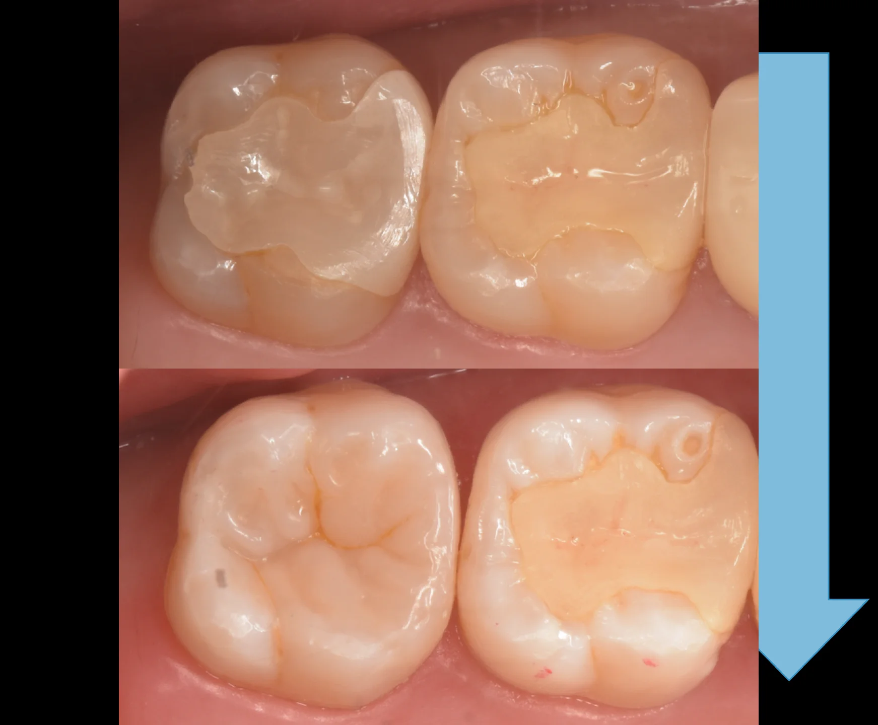 足立区からお越しの方。｜坂寄歯科医院（取手市藤代） - 画像8