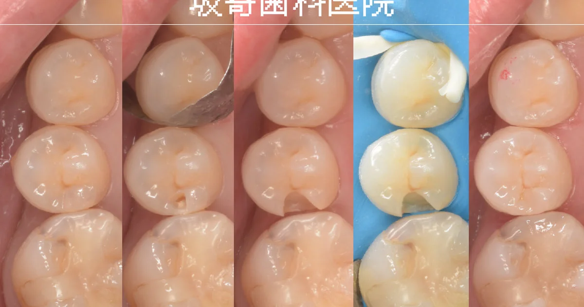 ブログ・お役立ち情報｜坂寄歯科医院（取手市藤代）