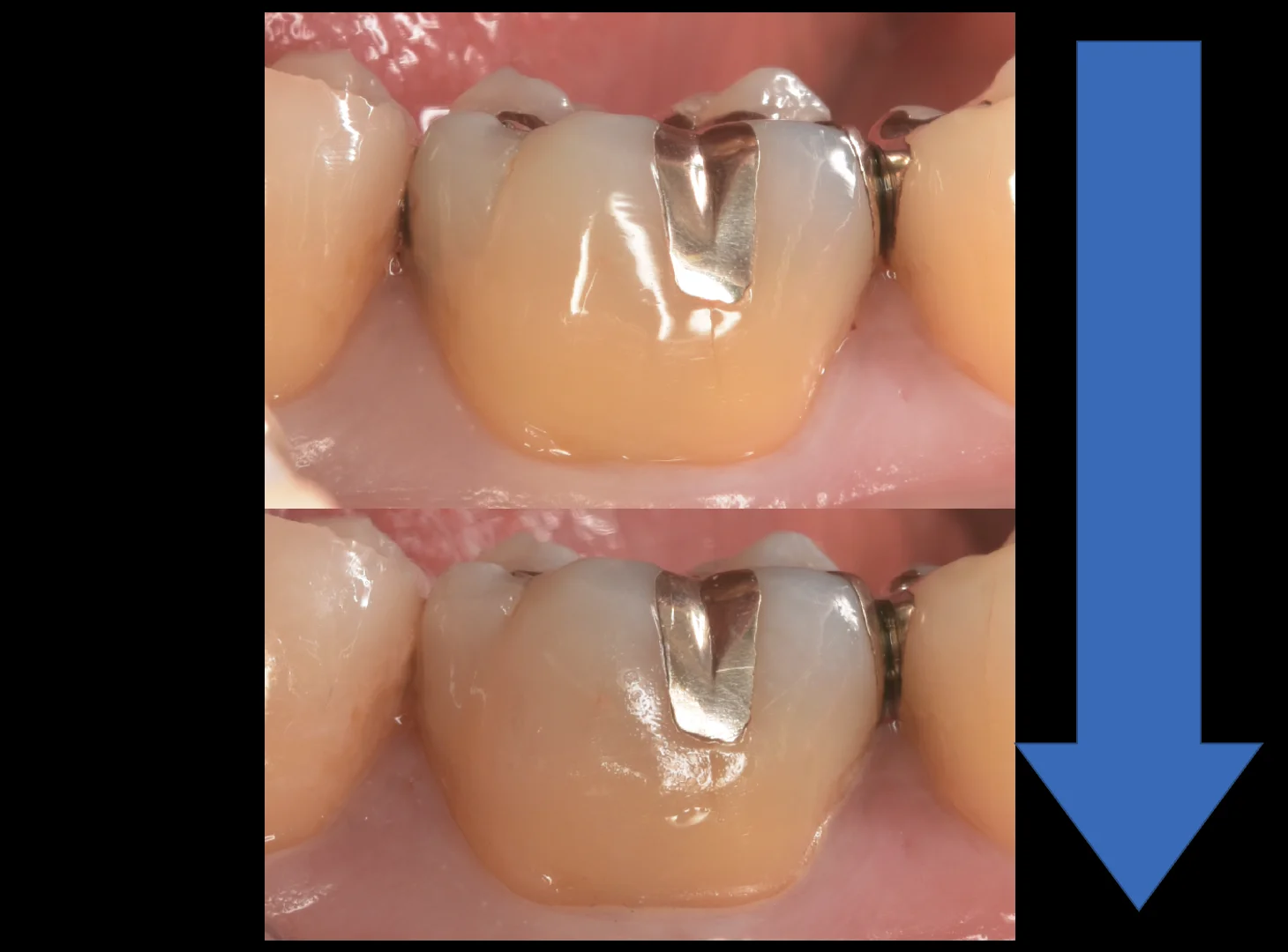 栃木県からお越しの方。｜坂寄歯科医院（取手市藤代） - 画像5