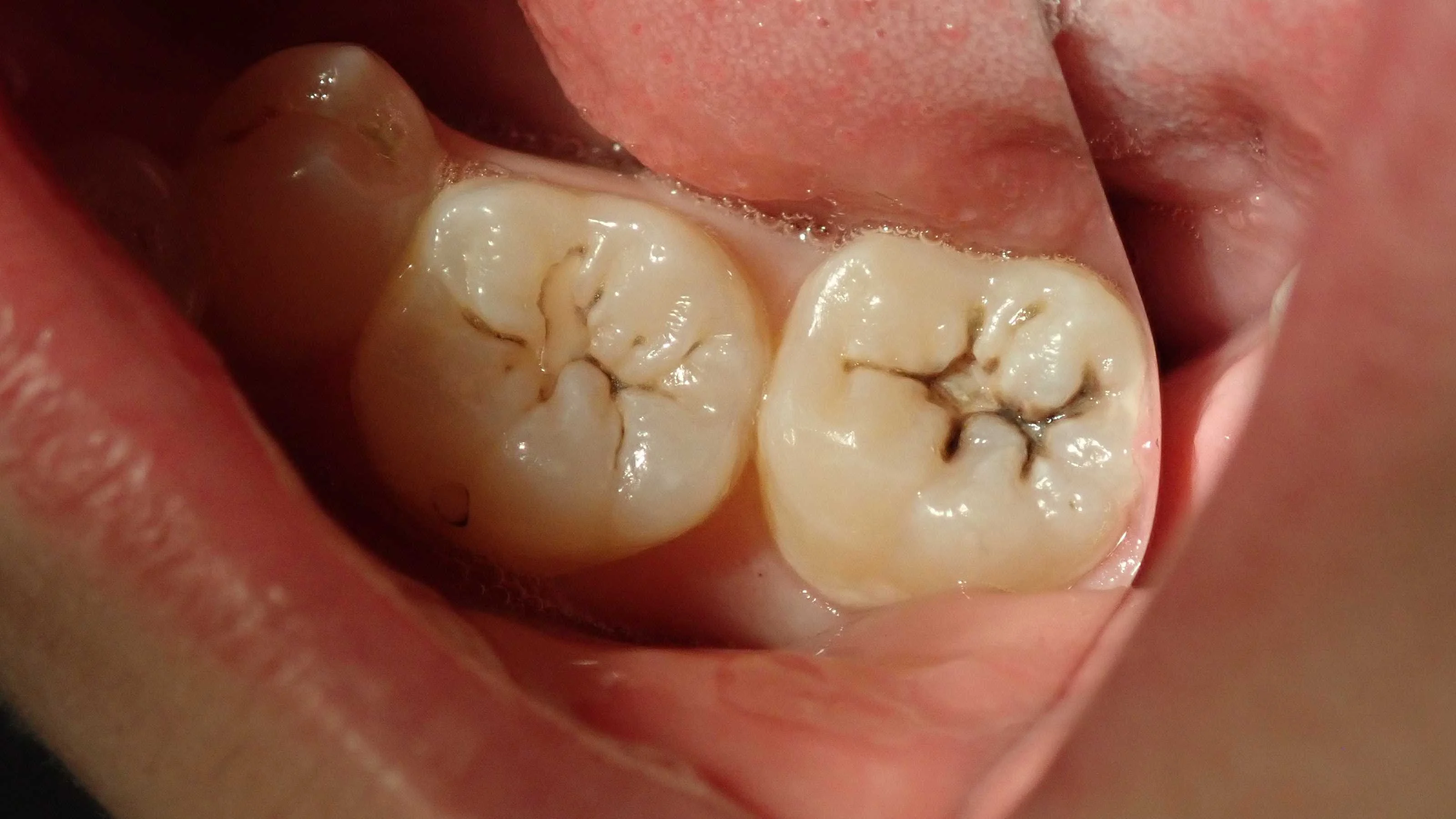 ブログ・お役立ち情報｜坂寄歯科医院（取手市藤代）