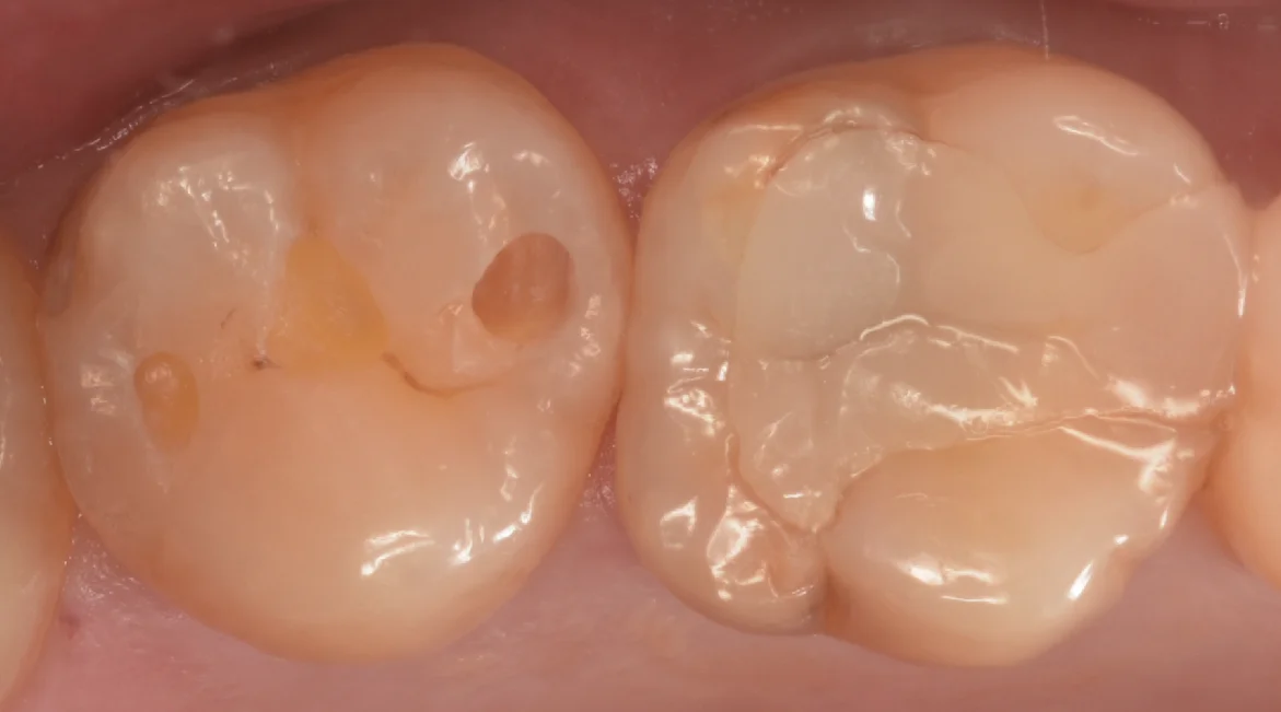 他県より来院された方。|坂寄歯科医院(取手市藤代) - 画像3