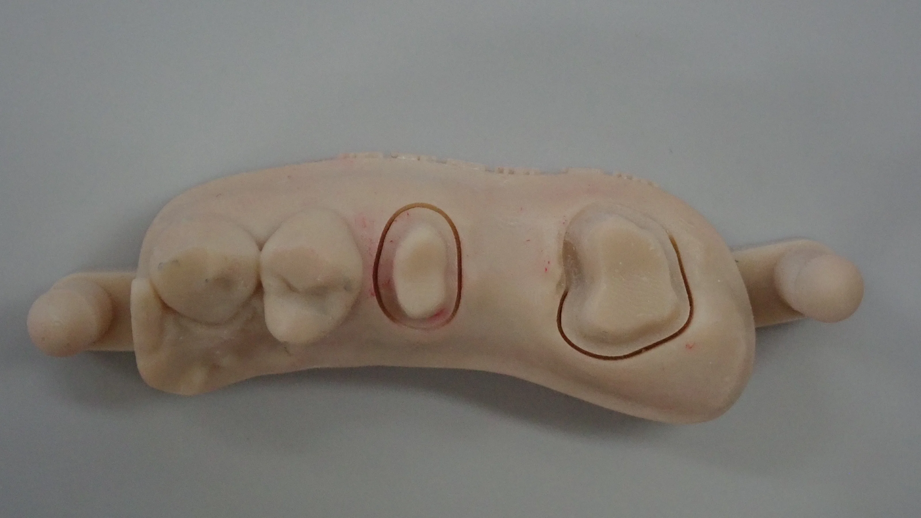 ブログ・お役立ち情報｜坂寄歯科医院（取手市藤代）